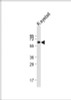 Western Blot at 1:2000 dilution + rat eyeball lysate Lysates/proteins at 20 ug per lane.