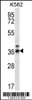 Western blot analysis in K562 cell line lysates (35ug/lane) .