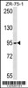 Western blot analysis in ZR-75-1 cell line lysates (35ug/lane) .