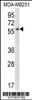 Western blot analysis in MDA-MB231 cell line lysates (35ug/lane) .