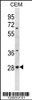 Western blot analysis in CEM cell line lysates (35ug/lane) .