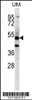 Western blot analysis in uterus tumor cell line lysates (35ug/lane) .