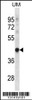 Western blot analysis in uterus tumor cell line lysates (35ug/lane) .