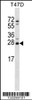 Western blot analysis in T47D cell line lysates (35ug/lane) .