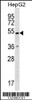 Western blot analysis in HepG2 cell line lysates (35ug/lane) .