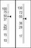 Western blot analysis of anti-hSUV39H2-K315 Pab (Cat. AP1281b) in 293 and HL60 cell line lysates (35ug/lane) .