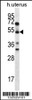 Western blot analysis in human normal Uterus tissue lysates (35ug/lane) .