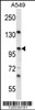 Western blot analysis in A549 cell line lysates (35ug/lane) .