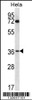 Western blot analysis in Hela cell line lysates (35ug/lane) .