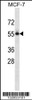 Western blot analysis in MCF-7 cell line lysates (35ug/lane) .