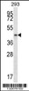 Western blot analysis in 293 cell line lysates (35ug/lane) .