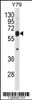 Western blot analysis in Y79 cell line lysates (35ug/lane) .