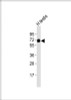 Western Blot at 1:2000 dilution + human testis lysates Lysates/proteins at 20 ug per lane.