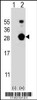 Western blot analysis of FKBP7 using rabbit polyclonal FKBP7 Antibody using 293 cell lysates (2 ug/lane) either nontransfected (Lane 1) or transiently transfected (Lane 2) with the FKBP7 gene.