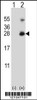 Western blot analysis of RNF11 using rabbit polyclonal RNF11 Antibody using 293 cell lysates (2 ug/lane) either nontransfected (Lane 1) or transiently transfected (Lane 2) with the RNF11 gene.