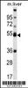 Western blot analysis in mouse liver tissue lysates (35ug/lane) .