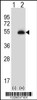 Western blot analysis of PAX6 using rabbit polyclonal PAX6 Antibody using 293 cell lysates (2 ug/lane) either nontransfected (Lane 1) or transiently transfected (Lane 2) with the PAX6 gene.