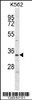 Western blot analysis in K562 cell line lysates (35ug/lane) .