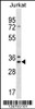 Western blot analysis in Jurkat cell line lysates (35ug/lane) .