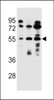 Western blot analysis in ZR-75-1, NCI-H292, 293 cell line lysates (35ug/lane) .
