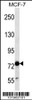 Western blot analysis in MCF-7 cell line lysates (35ug/lane) .