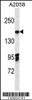 Western blot analysis in A2058 cell line lysates (35ug/lane) .