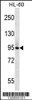 Western blot analysis in HL-60 cell line lysates (35ug/lane) .