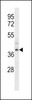 Western blot analysis in ZR-75-1 cell line lysates (35ug/lane) .