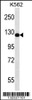 Western blot analysis in K562 cell line lysates (35ug/lane) .