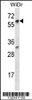 Western blot analysis in WiDr cell line lysates (35ug/lane) .