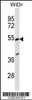 Western blot analysis in WiDr cell line lysates (35ug/lane) .