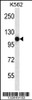 Western blot analysis in K562 cell line lysates (35ug/lane) .