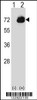 Western blot analysis of CTPS2 using rabbit polyclonal CTPS2 Antibody using 293 cell lysates (2 ug/lane) either nontransfected (Lane 1) or transiently transfected (Lane 2) with the CTPS2 gene.