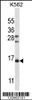 Western blot analysis in K562 cell line lysates (35ug/lane) .