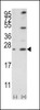 Western blot analysis of Bcl-w3 using rabbit polyclonal Bcl-w BH3 Domain Antibody using 293 cell lysates (2 ug/lane) either nontransfected (Lane 1) or transiently transfected with the BCL2L2 gene (Lane 2) .