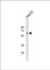 Western Blot at 1:1000 dilution + HepG2 whole cell lysate Lysates/proteins at 20 ug per lane.