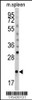 Western blot analysis of (S61) in mouse spleen tissue lysates (35ug/lane)