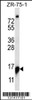 Western blot analysis in ZR-75-1 cell line lysates (35ug/lane) .