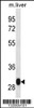 Western blot analysis in mouse liver tissue lysates (35ug/lane) .