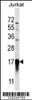 Western blot analysis in Jurkat cell line lysates (35ug/lane) .