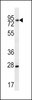 Western blot analysis in mouse brain tissue lysates (35ug/lane) .