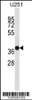 Western blot analysis in U251 cell line lysates (35ug/lane) .