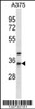 Western blot analysis in A375 cell line lysates (35ug/lane) .