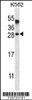 Western blot analysis in K562 cell line lysates (35ug/lane) .