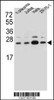 Western blot analysis in human placenta tissue and Jurkat, Hela, ZR-75-1 cell line lysates (35ug/lane) .