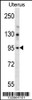 Western blot analysis in human normal Uterus tissue lysates (35ug/lane) .