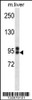 Western blot analysis in mouse liver tissue lysates (35ug/lane) .