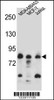 Western blot analysis in MDA-MB453, MCF-7, Jurkat cell line lysates (35ug/lane) .