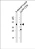 Western Blot at 1:2000 dilution Lane 1: human skeletal muscle lysates Lane 2: CCRF-CEM whole cell lysates Lysates/proteins at 20 ug per lane.