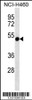 Western blot analysis in NCI-H460 cell line lysates (35ug/lane) .